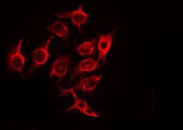 Polyclonal Rabbit anti-Human ZNHIT6 / C1orf181 Antibody (IF, WB)