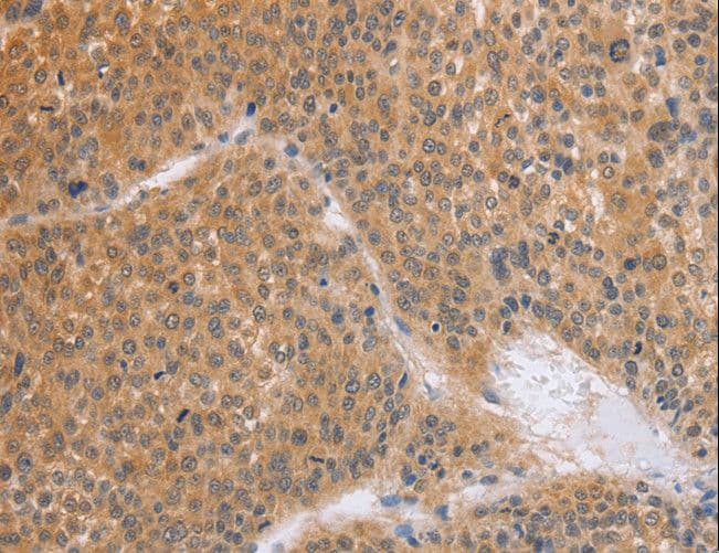 BRS3 Antibody