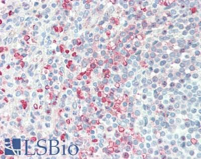 IHC-plus™ EVI2B Antibody (aa283-313)