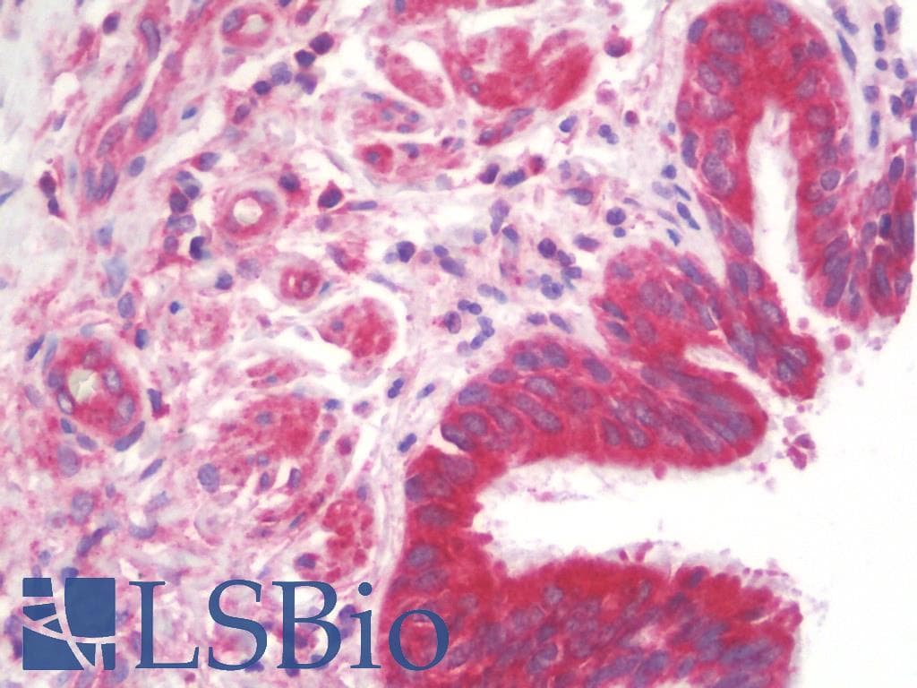 IHC-plus™ Polyclonal Rabbit anti-Human TPT1 / TCTP Antibody (IHC, IF, WB)