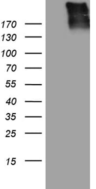 Gravin / AKAP12 Antibody (aa266-557, clone OTI1B6)