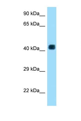 AADACL3 Antibody (aa224-273)