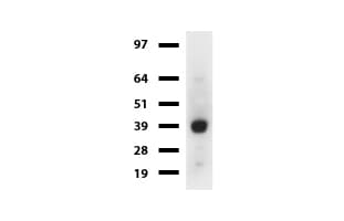 SYP / Synaptophysin Antibody (clone UMAB112)