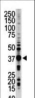 STK16 Antibody (aa257-286)