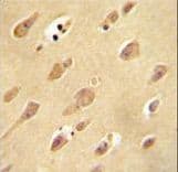 OR5L2 Antibody (aa62-90)
