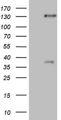 Monoclonal Mouse anti-Human SREBF2 / SREBP2 Antibody (clone OTI4G1, aa117-380, WB)