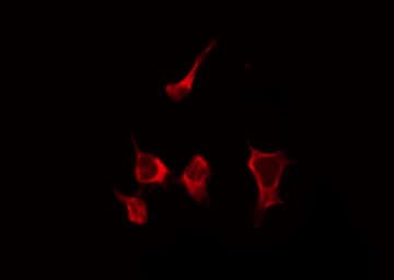 LGALS9 / Galectin 9 Antibody