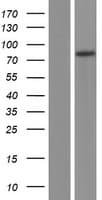 PHTF2 Protein (Over-Expression Lysate Myc-DDK (Flag))