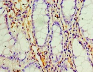 LGALS1 / Galectin 1 Antibody (aa2-135, Biotin)