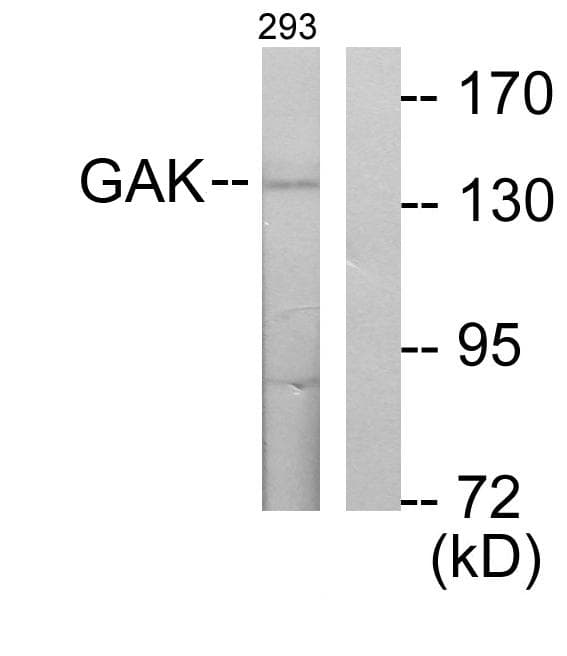 GAK Antibody