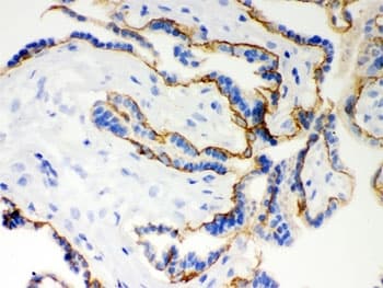 CDH1 / E Cadherin Antibody