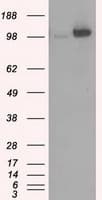 HK2 / Hexokinase 2 Antibody (clone OTI4C5)