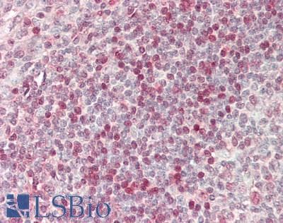 IHC-plus™ Monoclonal Mouse anti-Human MCPH1 Antibody (clone 1B2, aa1-264, IHC, WB)