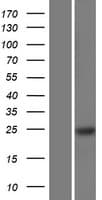 RBM24 Protein (Over-Expression Lysate Myc-DDK (Flag))