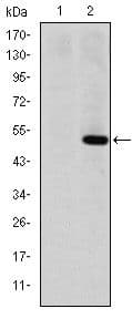 Monoclonal Mouse anti-Human MMP1 Antibody (clone 6A5, IHC, IF, WB)