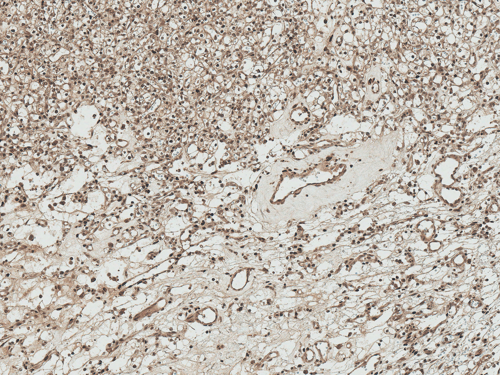 Apg7 / ATG7 Antibody (RPE)
