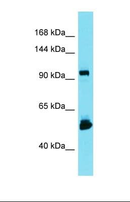 Polyclonal Rabbit anti-Human KIAA1429 Antibody (aa1028-1077, WB)