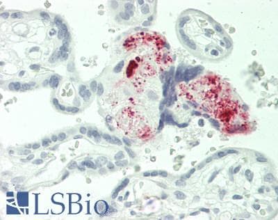 IHC-plus™ MGP / Matrix Gla-Protein Antibody (clone 11G8)