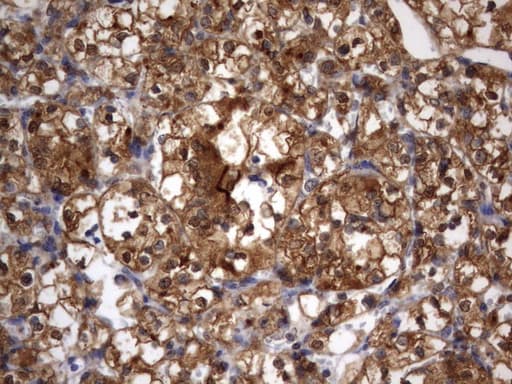 HMBS / PBGD Antibody (clone UMAB144)