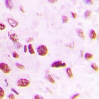 Polyclonal Rabbit anti-Human SMAD6 Antibody (Internal, IHC, WB)