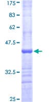 Human GUCY2D Protein (Recombinant GST, N-terminus)