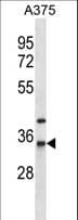 NAT1 / AAC1 Antibody (aa102-130)