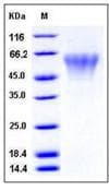 Human TLT2 / TREML2 Protein (Recombinant His,C-terminus)
