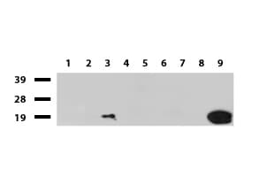 CRABP2 Antibody (clone UMAB176)