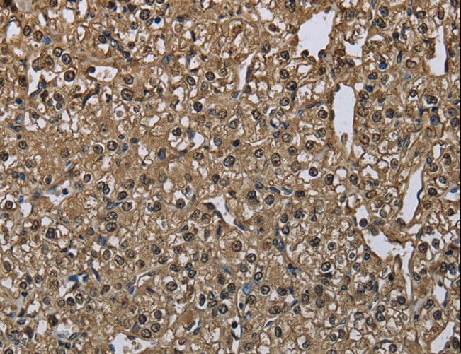 Polyclonal Rabbit anti-Human GSTA3 Antibody (IHC, WB)