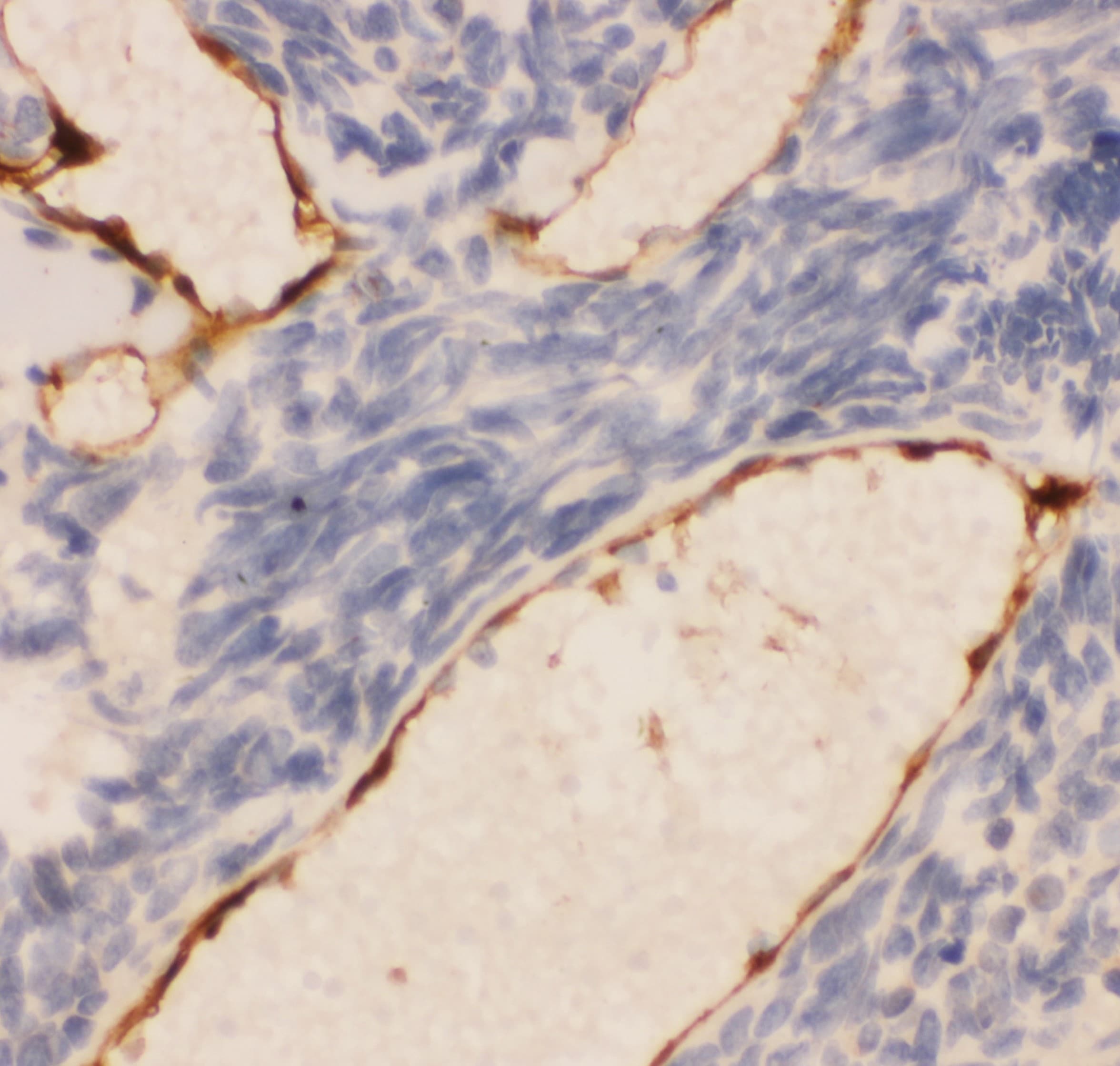 Polyclonal Rabbit anti-Human PECAM-1 / CD31 Antibody (aa28-382, IHC, WB)
