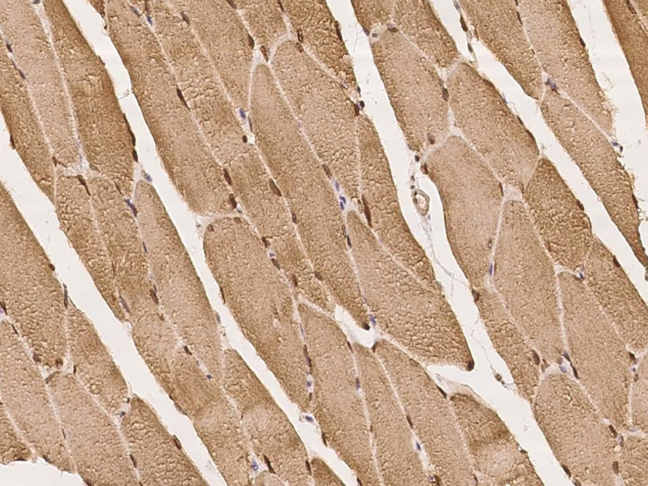 Polyclonal Rabbit anti-Human SYNE1 / Nesprin 1 Antibody (IHC)