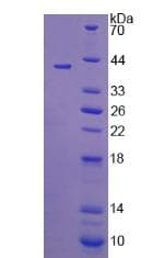 Rat HSD2 / HSD11B2 Protein (Recombinant His)