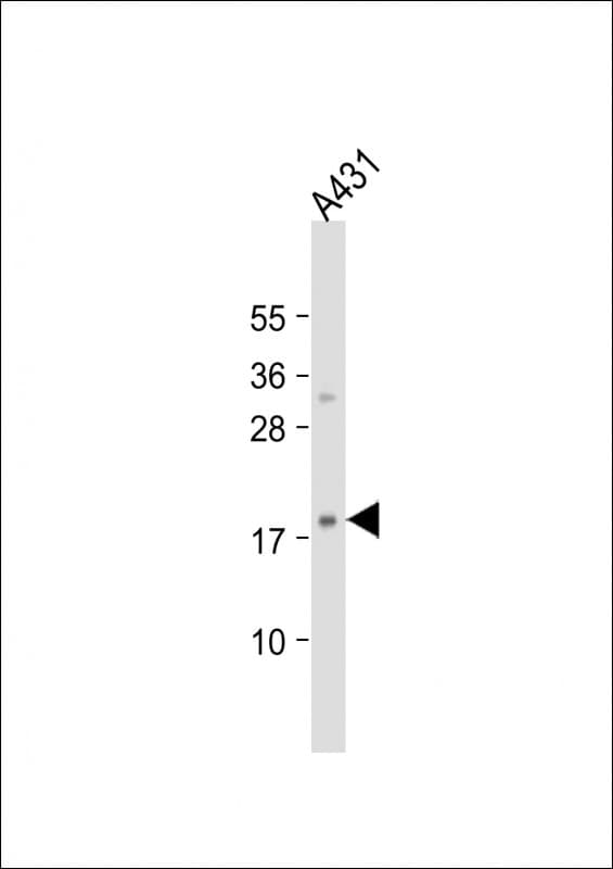 HIST1H3J Antibody (aa31-65)