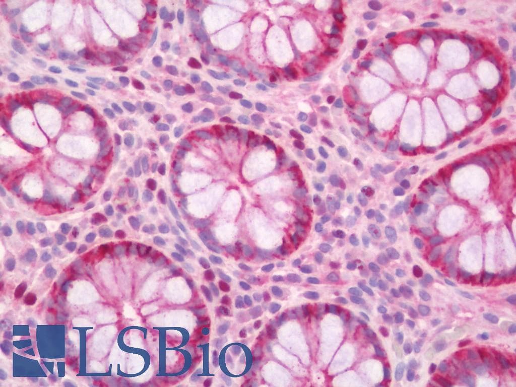 IHC-plus™ Polyclonal Goat anti-Human CDH1 / E Cadherin Antibody (IHC, WB)
