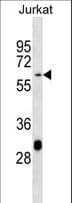MATN3 / Matrilin 3 Antibody (aa220-248)