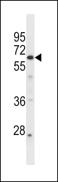 Polyclonal Rabbit anti-Human GPR107 / LUSTR1 Antibody (aa419-445, WB)