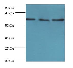 IHC-plus™ Polyclonal Rabbit anti-Human ATAD3A Antibody (aa1-240, IHC, WB)