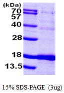 Human ISCU Protein (Recombinant His)