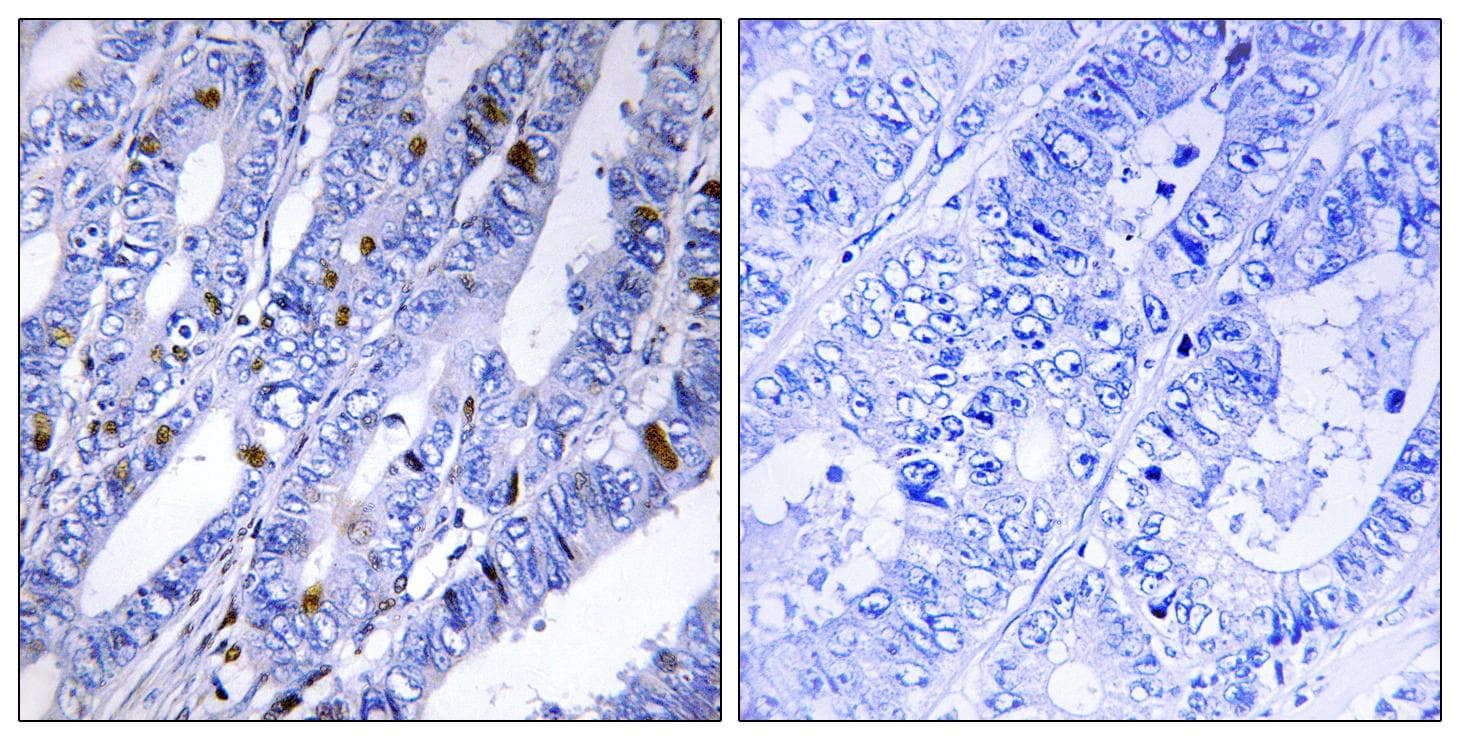 PRKAR2B Antibody (p113)