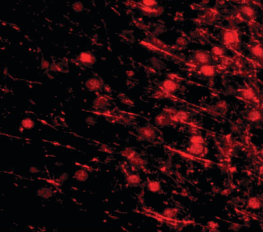 LRFN4 Antibody