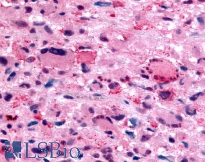 PathPlus™ FFAR2 / GPR43 Antibody (Extracellular Domain)