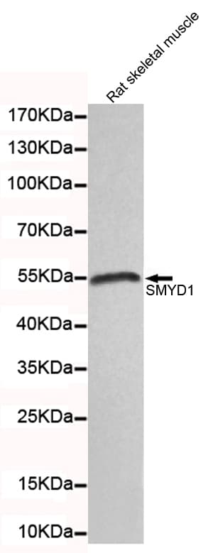 SMYD1 Antibody