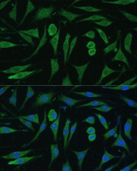 GAPVD1 Antibody