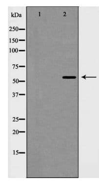 Polyclonal Rabbit anti-Human PIAS4 / PIASY Antibody (IHC, WB)