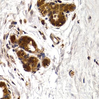 Polyclonal Rabbit anti-Human CTSS / Cathepsin S Antibody (IHC, WB)