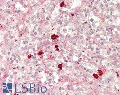 Polyclonal Rabbit anti-Human FCRL5 / CD307 Antibody (aa866-915, IHC, WB)