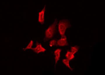 CSNK1G2 / CKI-Gamma 2 Antibody