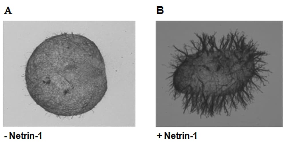 Human NTN1 / Netrin 1 Protein (Recombinant Human IgG1 Fc)