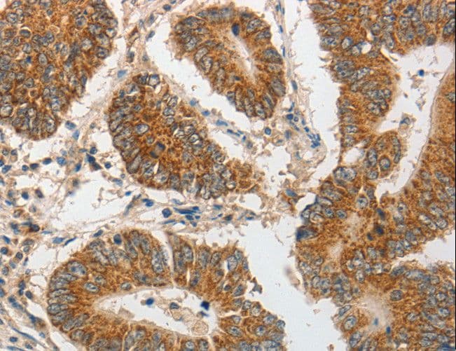 PIBF1 / PIBF Antibody