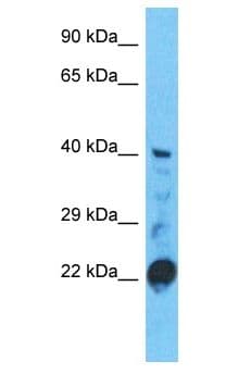 Polyclonal Rabbit anti-Human STAC3 Antibody (aa215-264, WB)